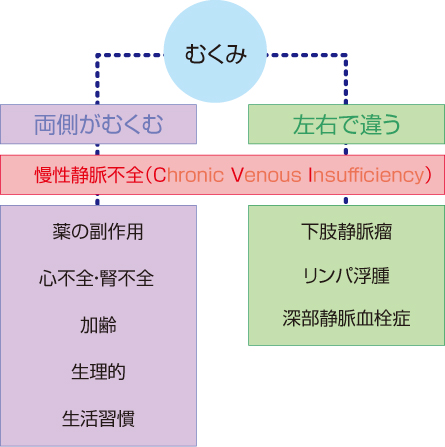 むくみの原因と部位_画像_1