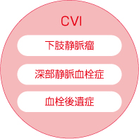 慢性静脈不全（CVI）と足のむくみ_画像_2