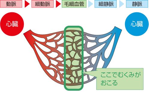 足のむくみとは？_画像_2