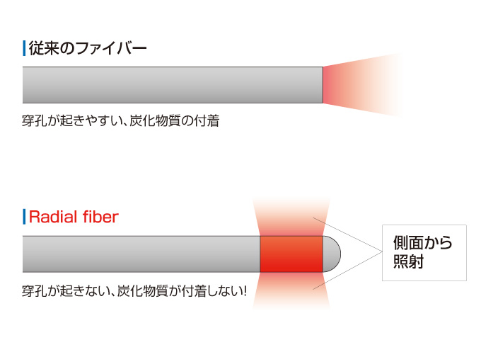 新しいファイバー