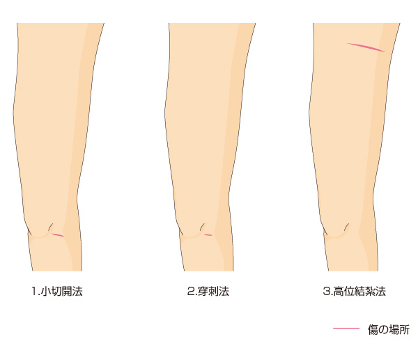 傷の場所